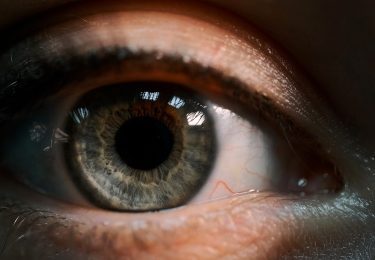 Ophthalmic imaging