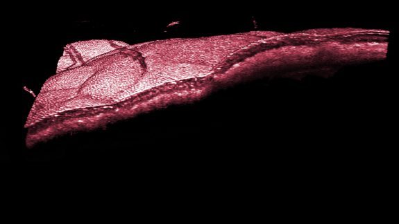 Optical Coherence Tomography, OCT