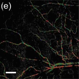 Microvascular-sO2-OCT